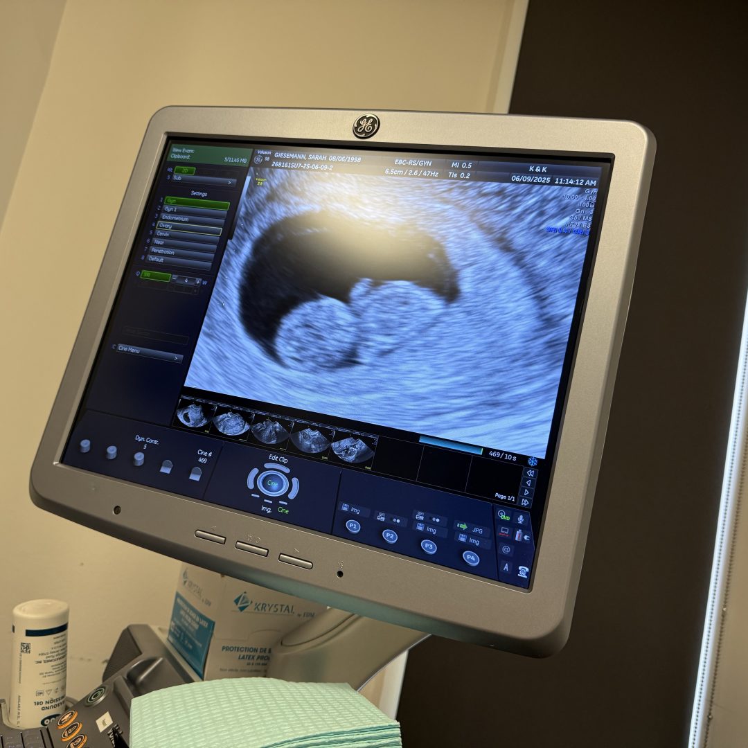 Photo shared by Sarah for their Babylist baby registry.