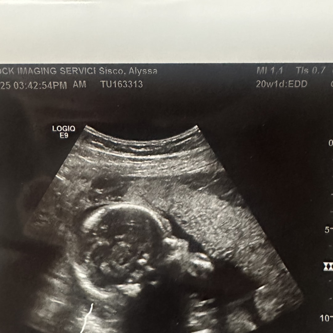 Photo shared by Alyssa for their Babylist baby registry.
