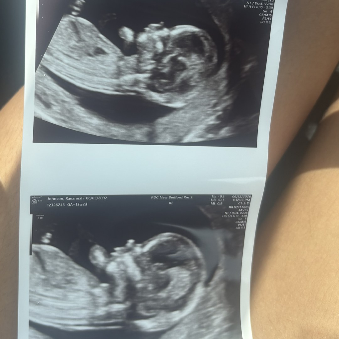 Photo shared by Raeannah for their Babylist baby registry.