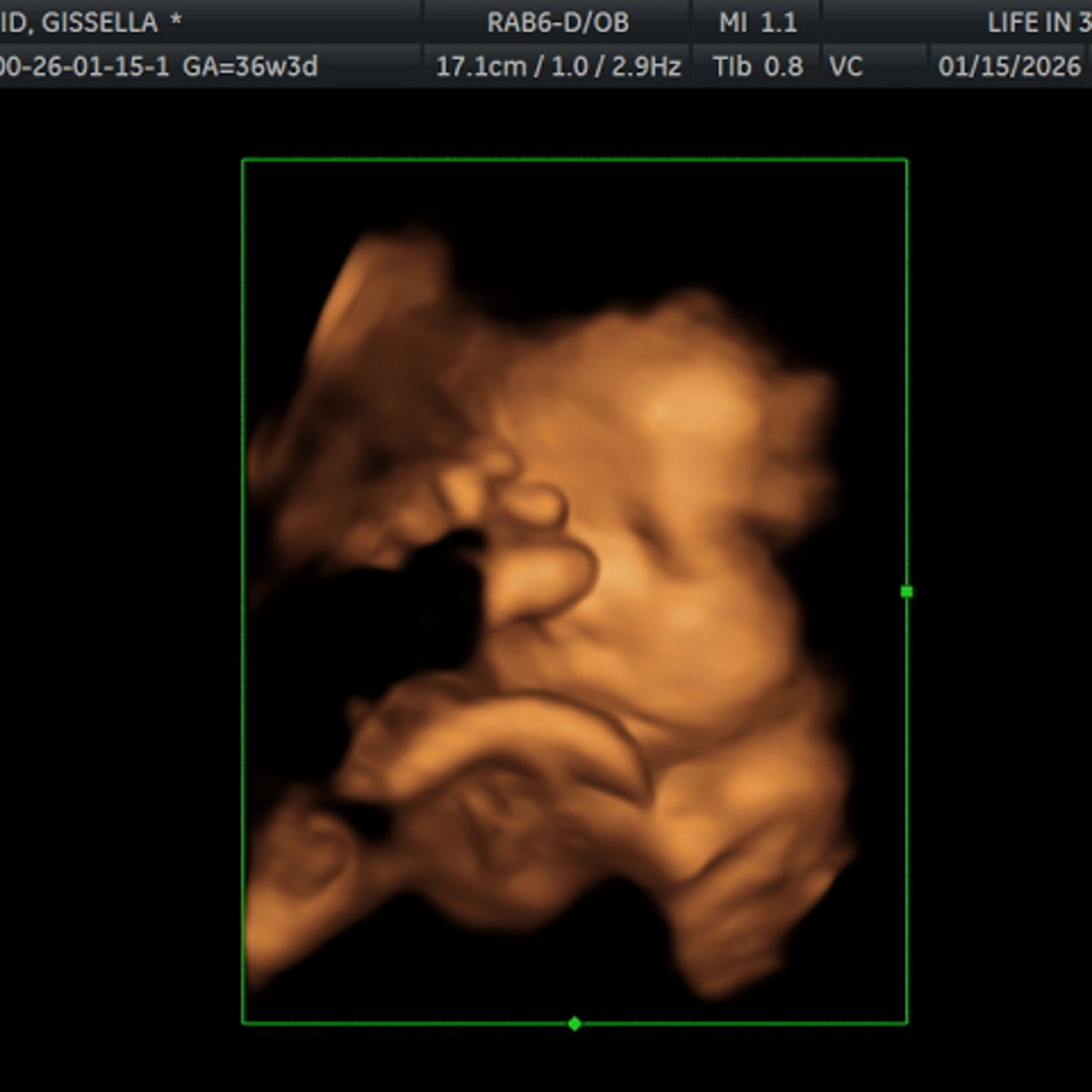 Photo shared by Gissella for their Babylist baby registry.