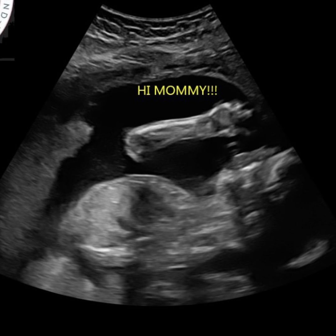 Photo shared by Jah’ni for their Babylist baby registry.