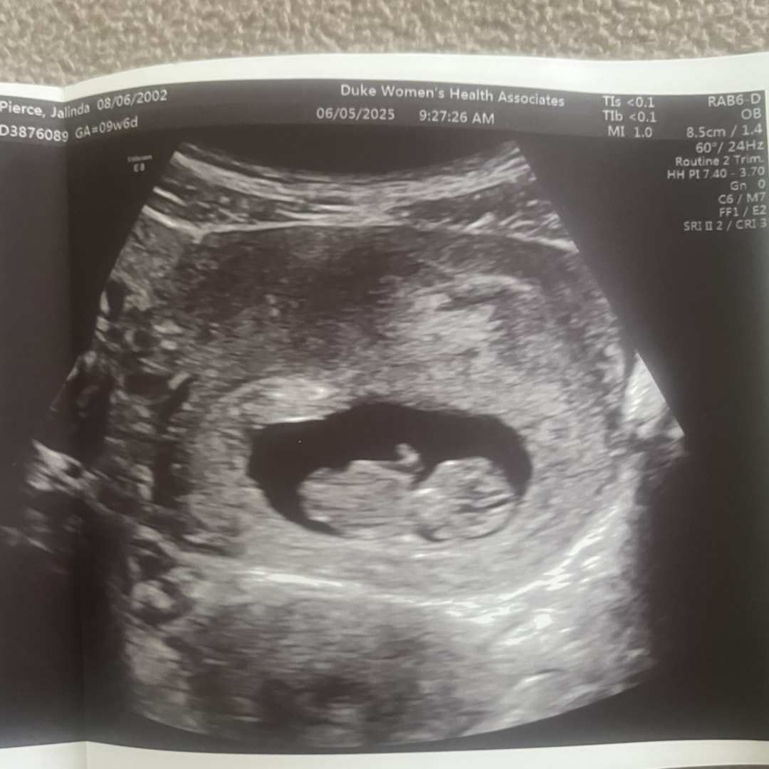 Photo shared by Jalinda for their Babylist baby registry.