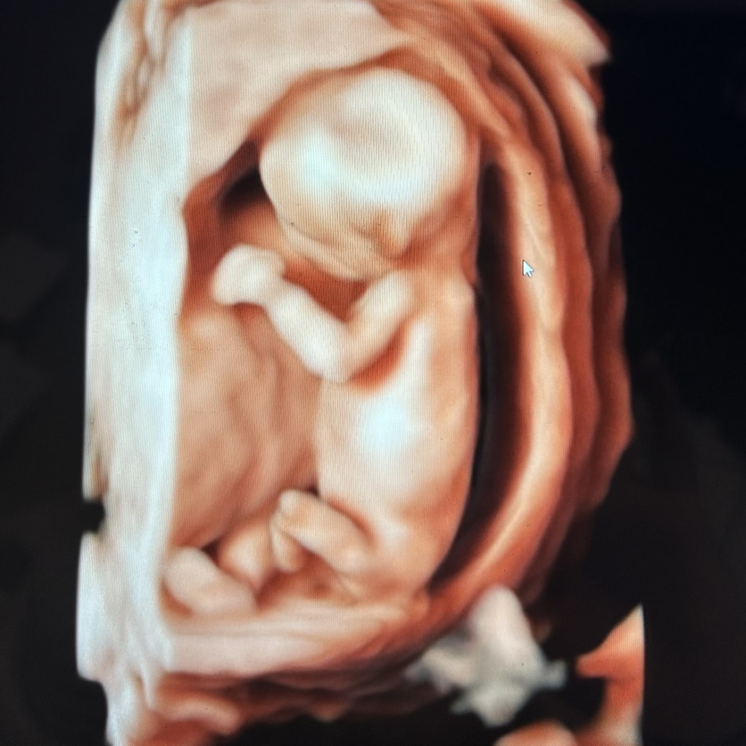 Photo shared by Emily for their Babylist baby registry.