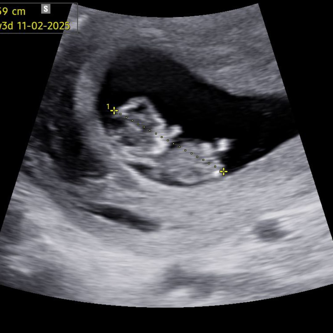 Photo shared by Jazlyn for their Babylist baby registry.