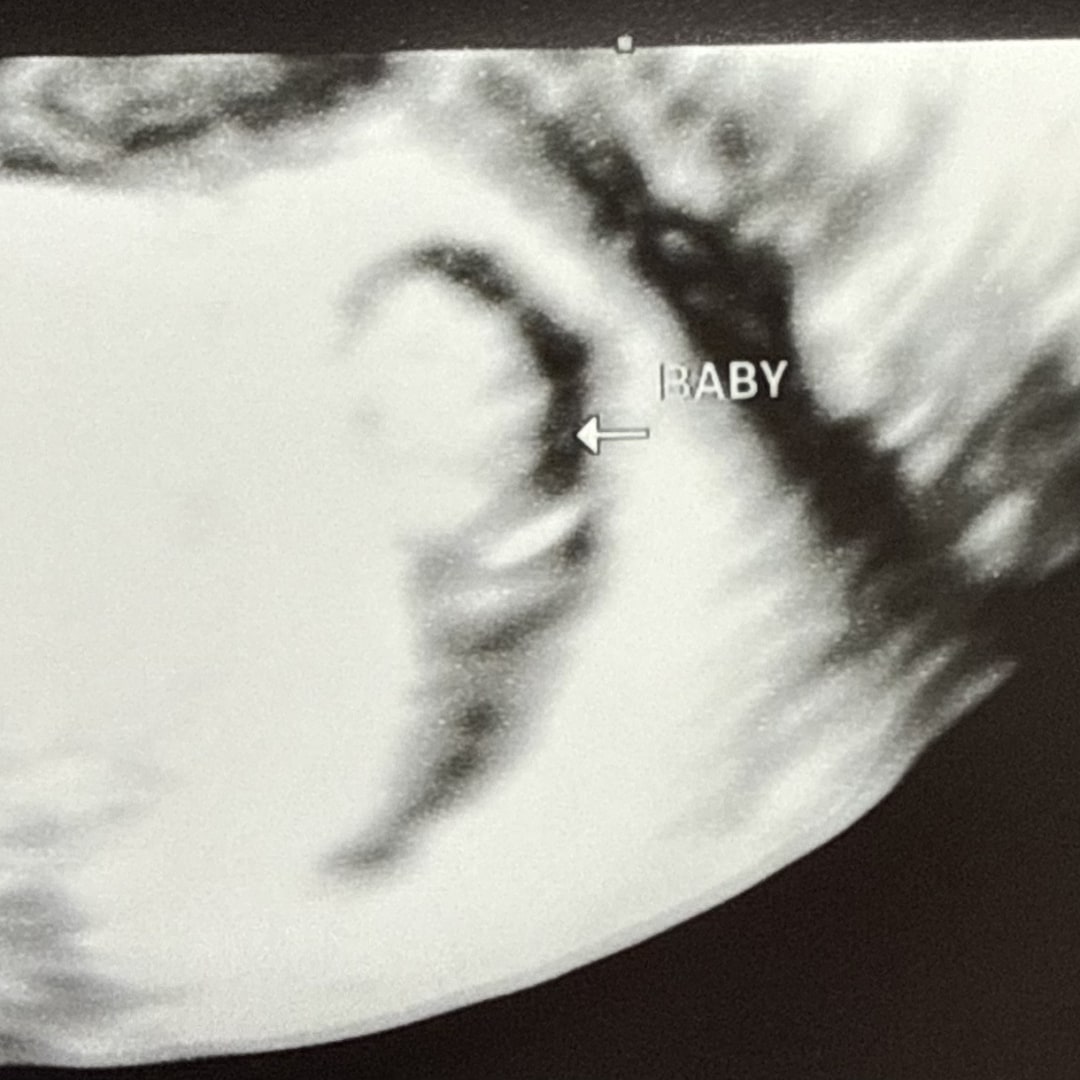 Photo shared by Breyauna for their Babylist baby registry.