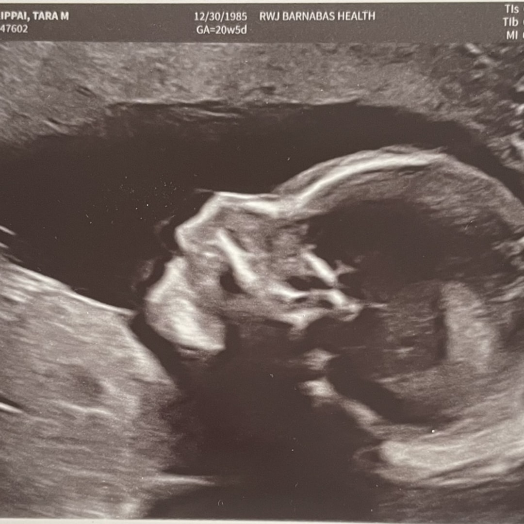 Photo shared by Tara for their Babylist baby registry.