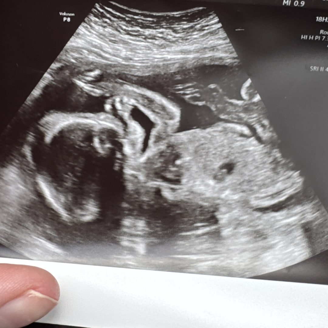 Photo shared by Haley for their Babylist baby registry.