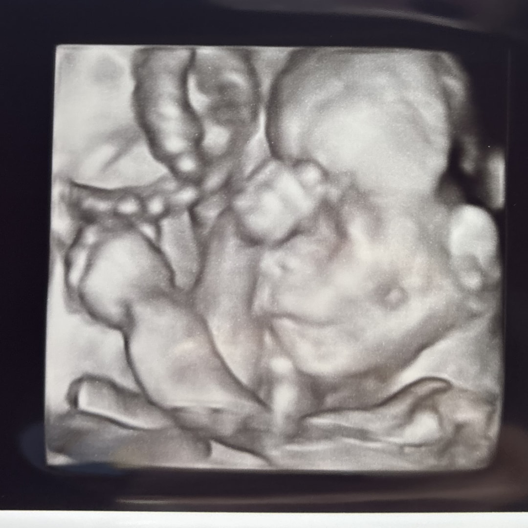 Photo shared by Desirae for their Babylist baby registry.
