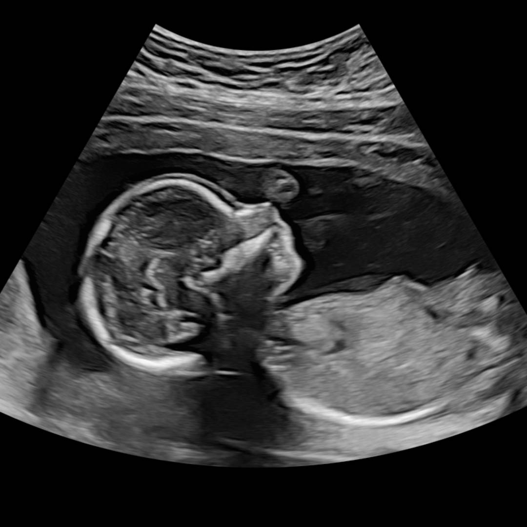 Photo shared by Megan for their Babylist baby registry.