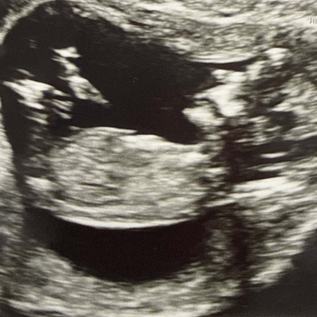 Photo shared by Rebecca for their Babylist baby registry.