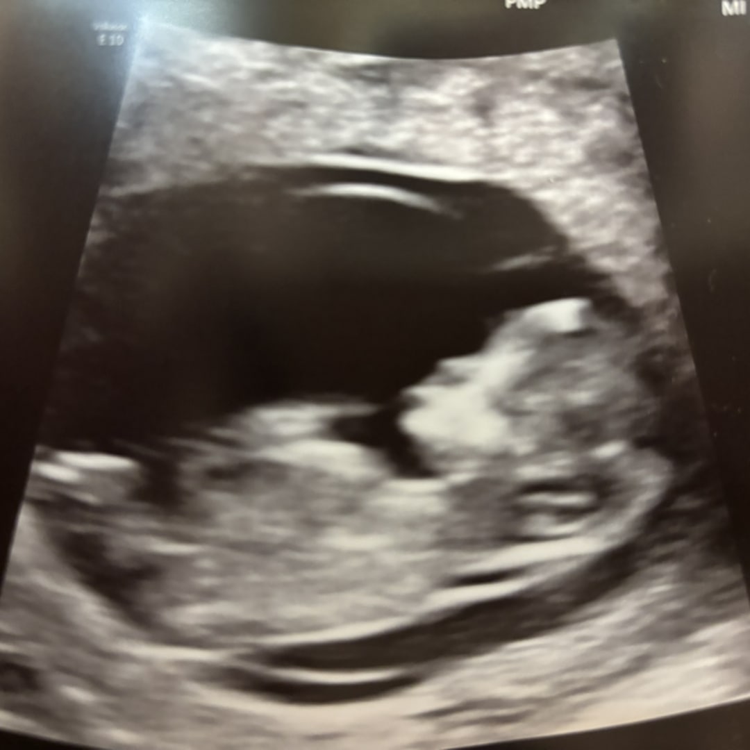 Photo shared by Jessica for their Babylist baby registry.