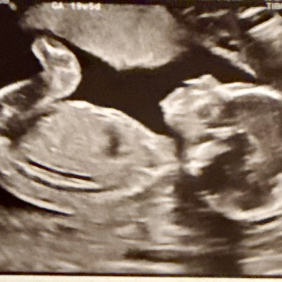 Photo shared by Maggie for their Babylist baby registry.