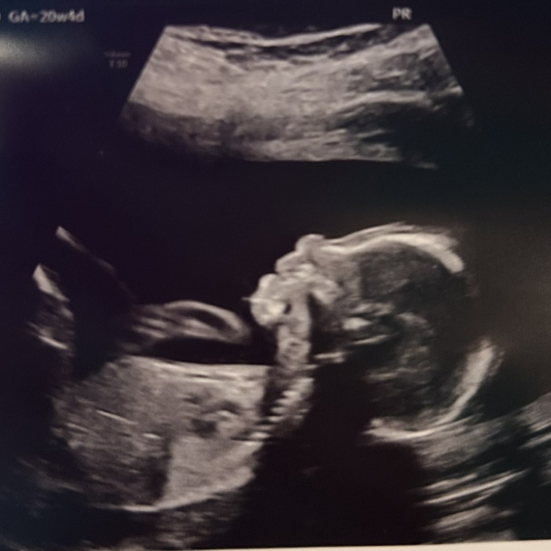Photo shared by Amanda for their Babylist baby registry.