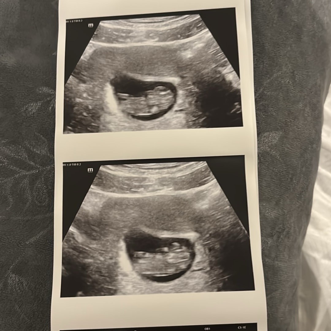 Photo shared by Jaeda for their Babylist baby registry.