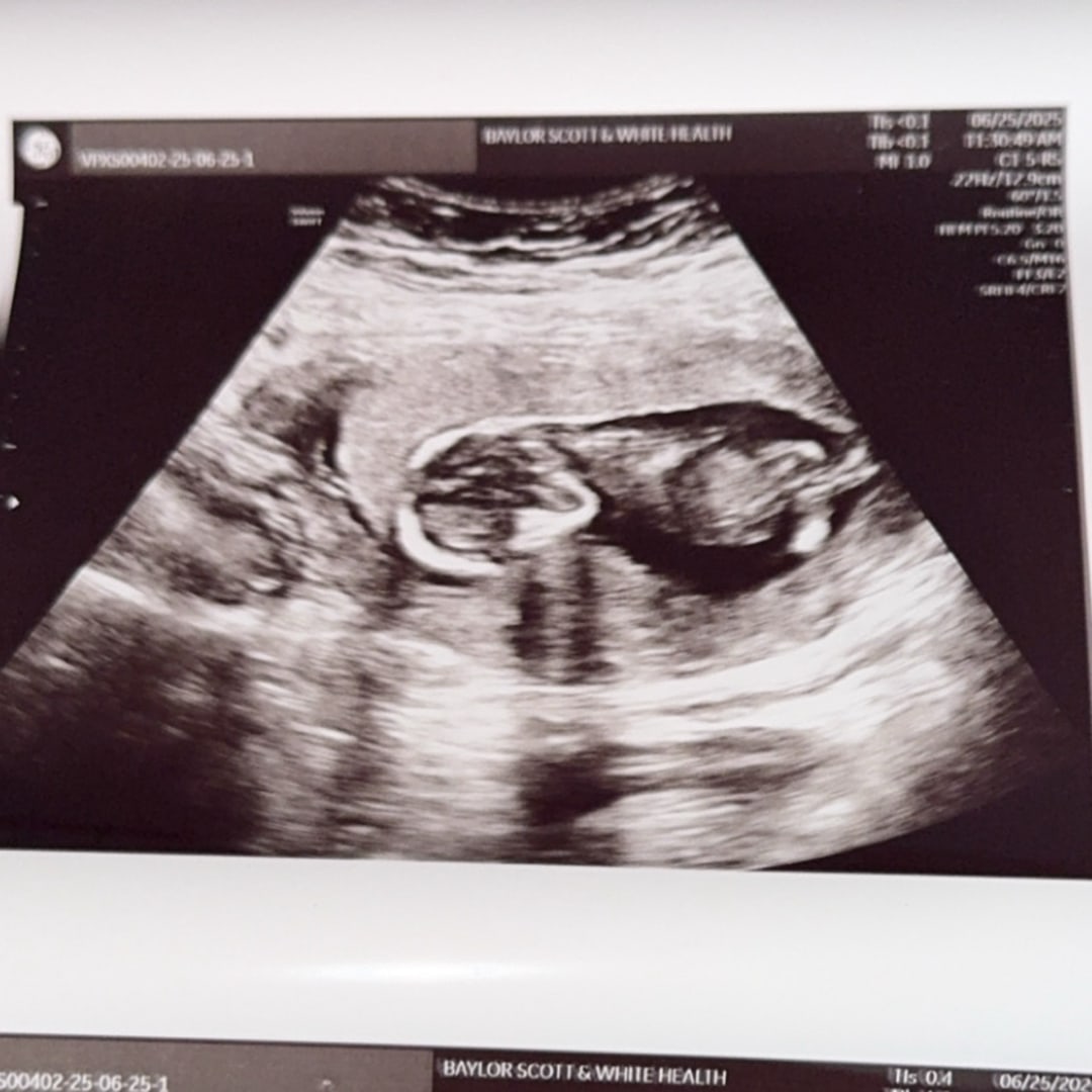 Photo shared by Hayley for their Babylist baby registry.