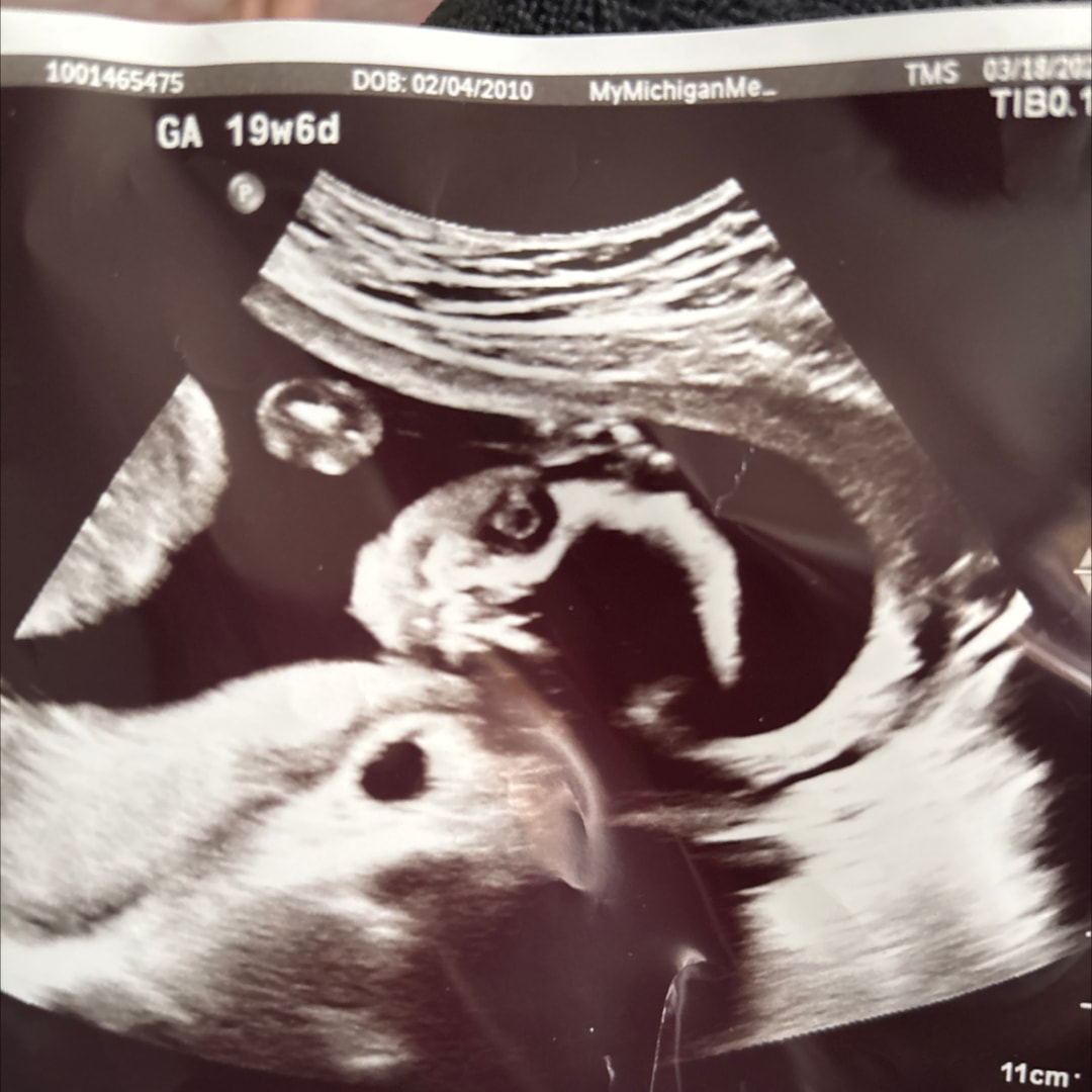 Photo shared by Cady for their Babylist baby registry.