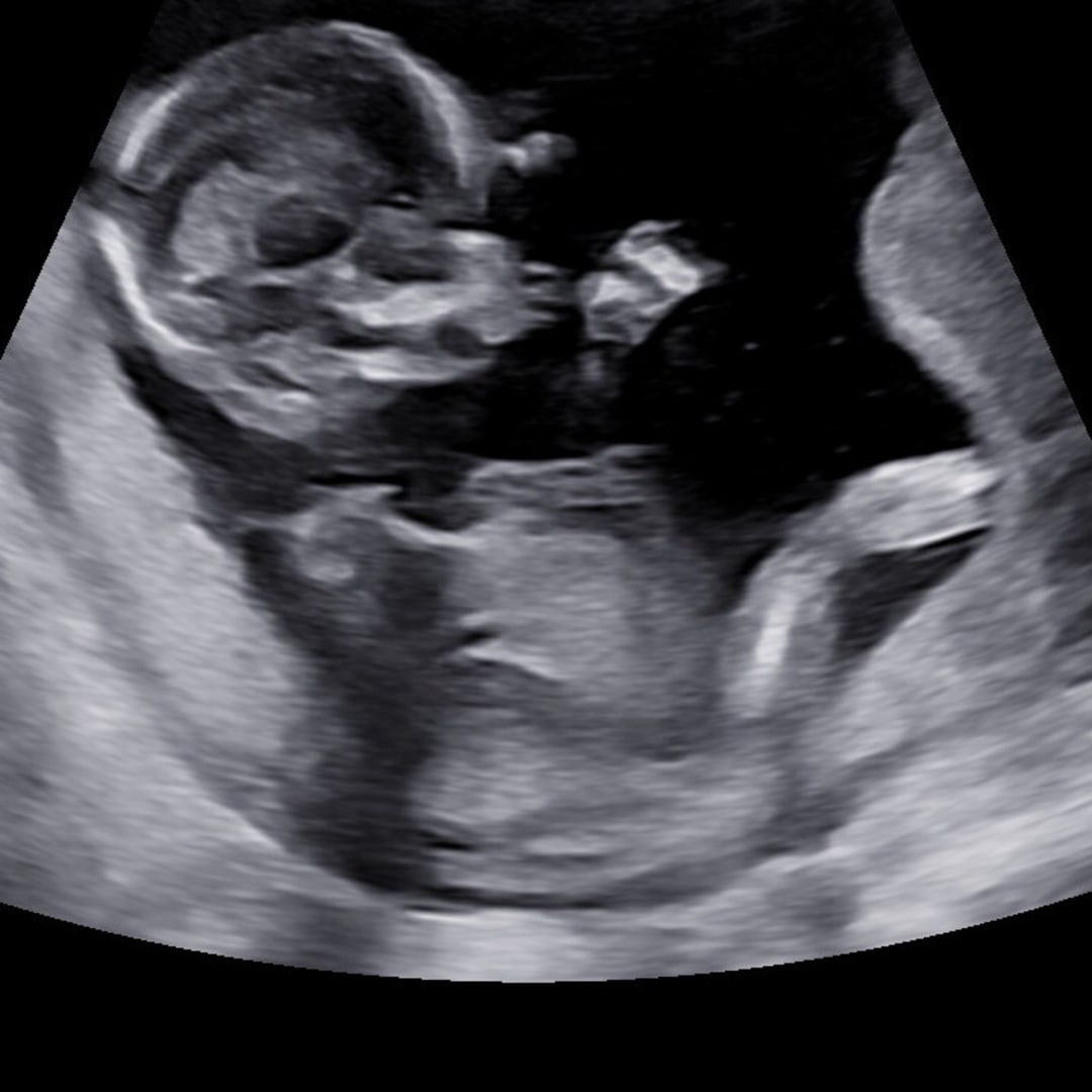 Photo shared by Elizabeth for their Babylist baby registry.