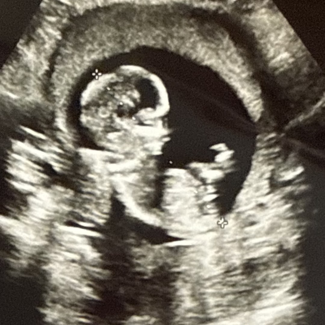 Photo shared by Makenzie for their Babylist baby registry.