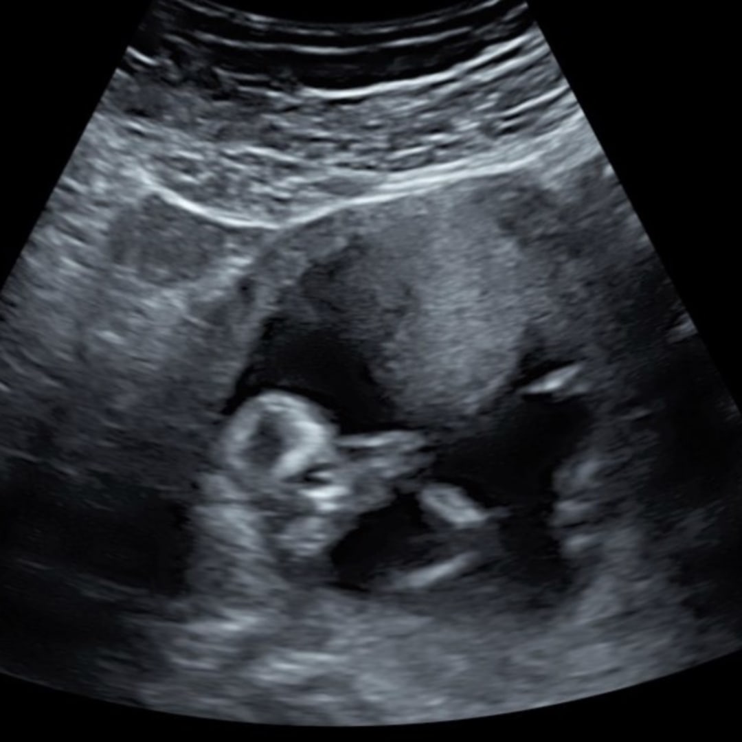 Photo shared by Frances for their Babylist baby registry.