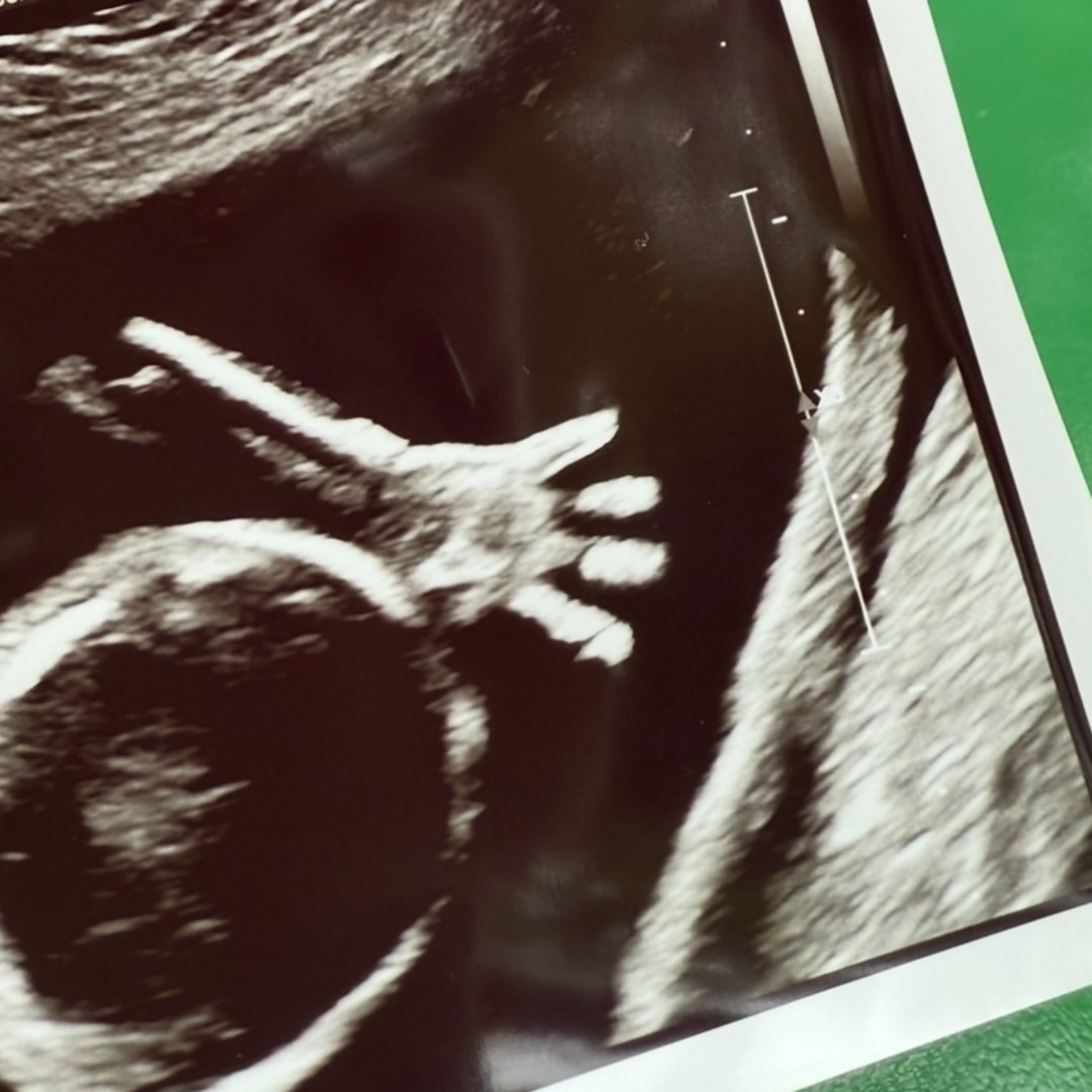 Photo shared by Emma for their Babylist baby registry.