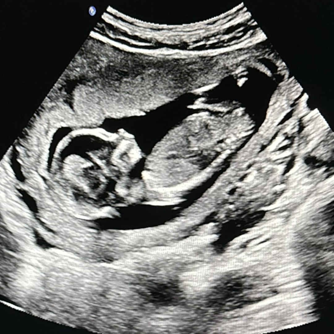 Photo shared by Brianna for their Babylist baby registry.