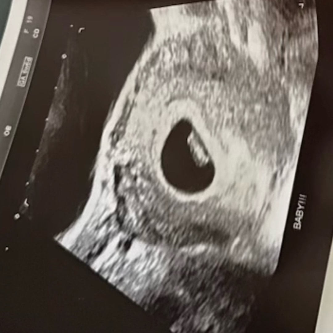 Photo shared by Bree for their Babylist baby registry.