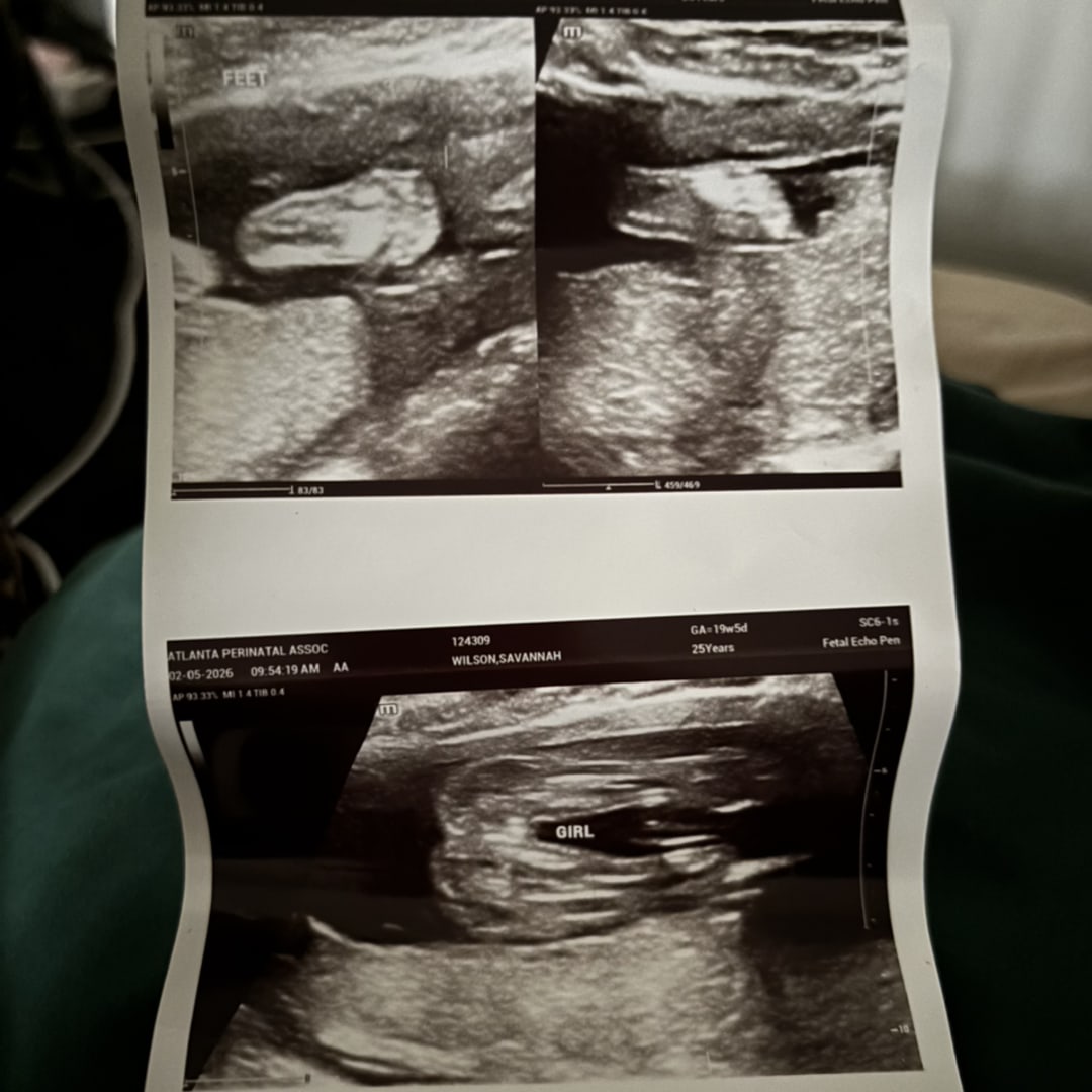 Photo shared by Savannah for their Babylist baby registry.