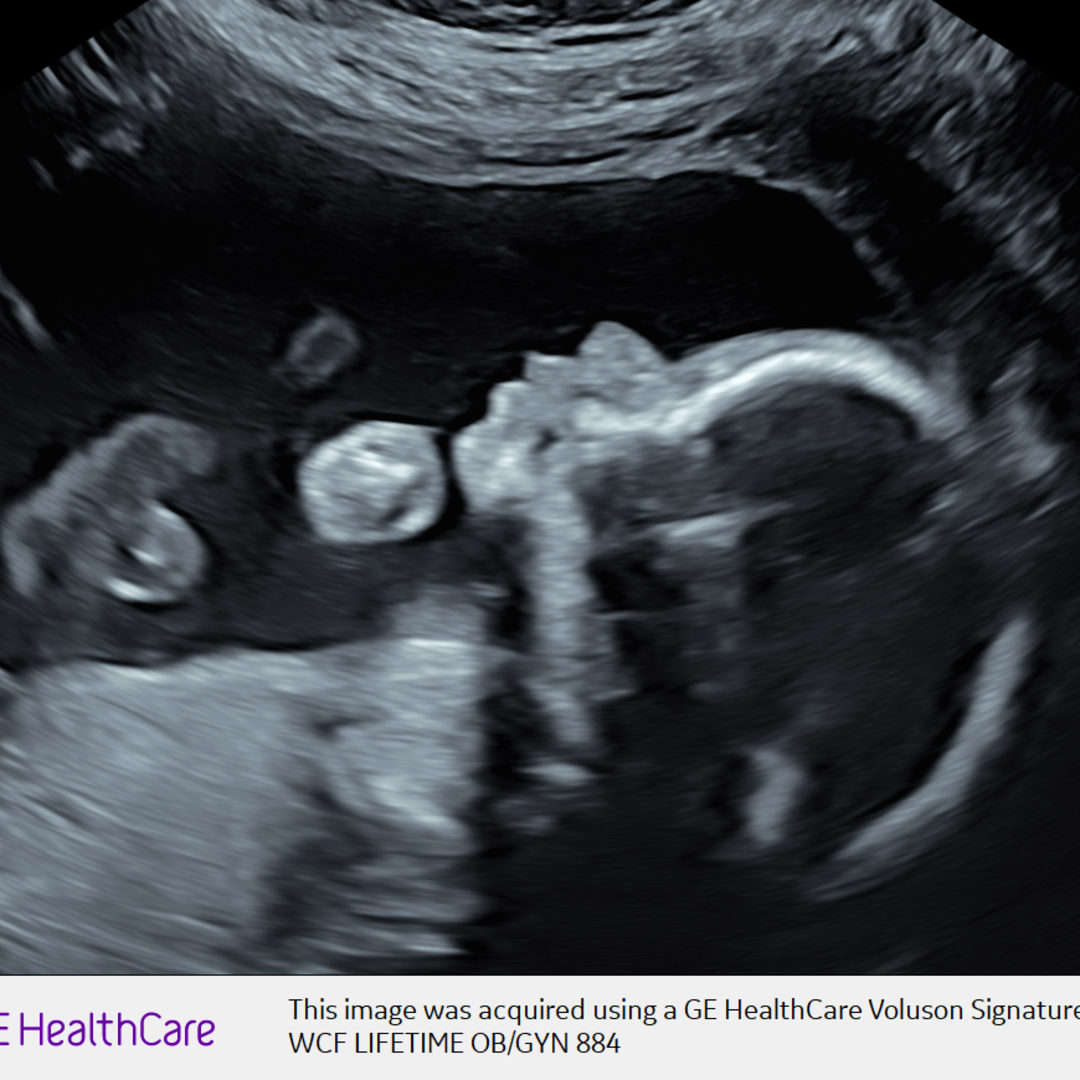 Photo shared by Alice for their Babylist baby registry.