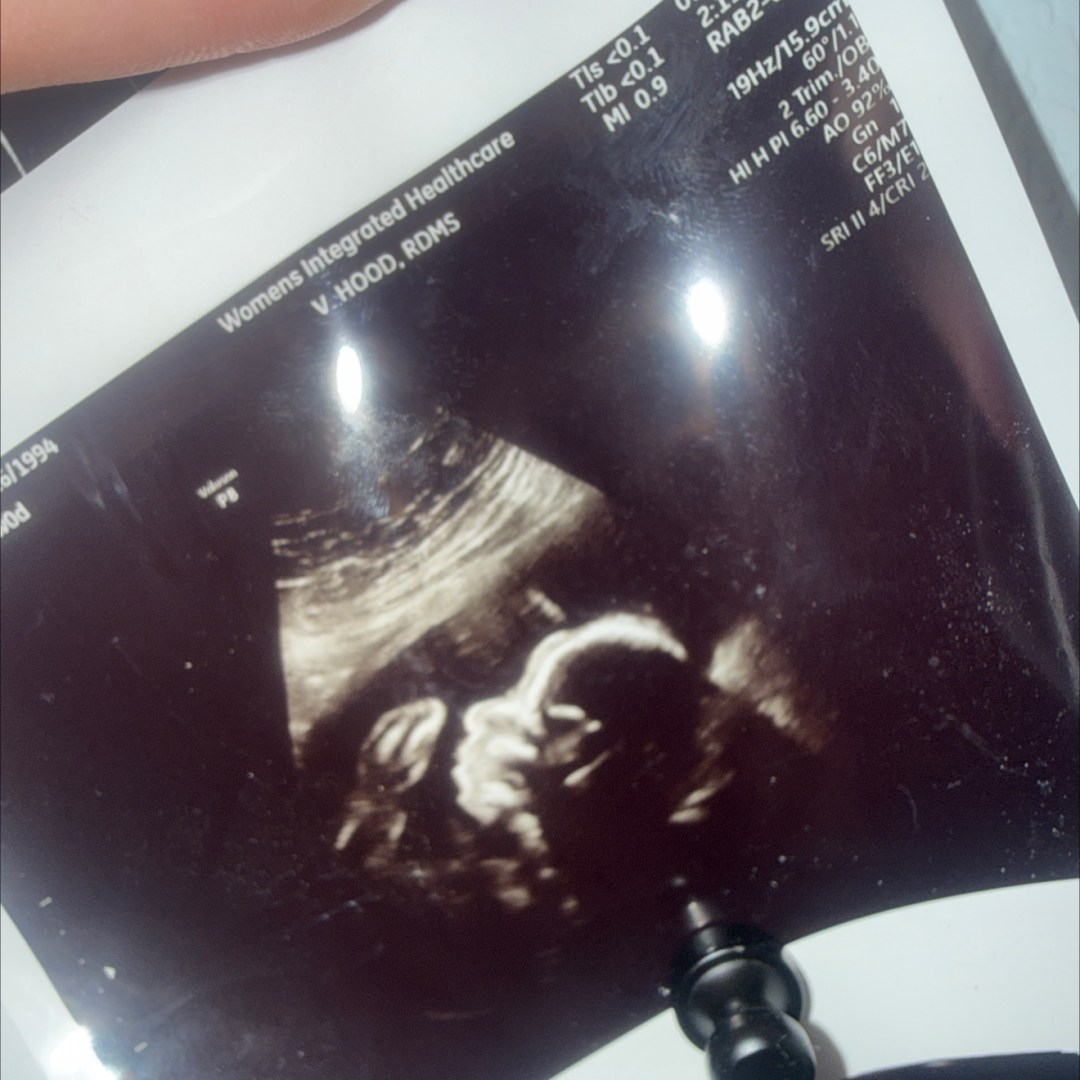 Photo shared by Sarah for their Babylist baby registry.