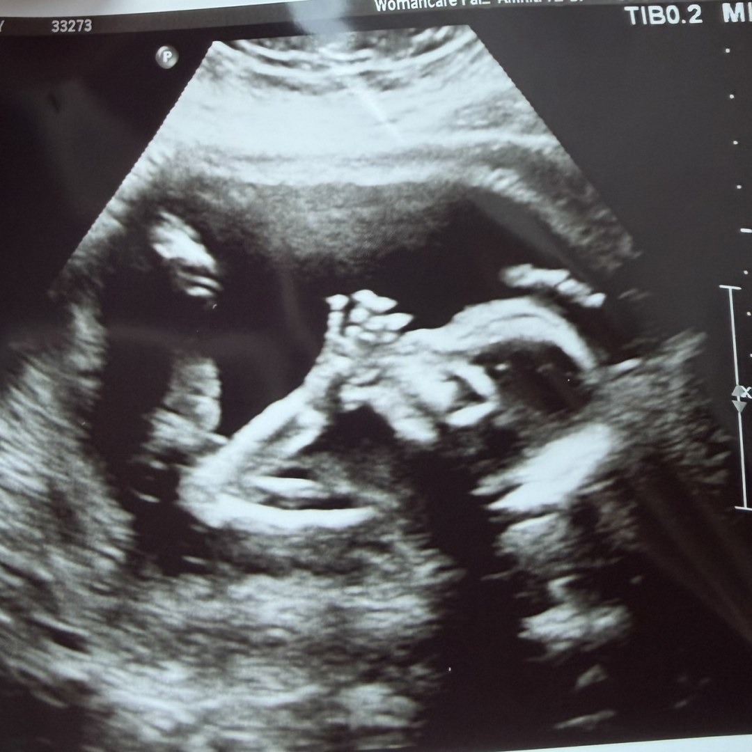 Photo shared by Brittany for their Babylist baby registry.