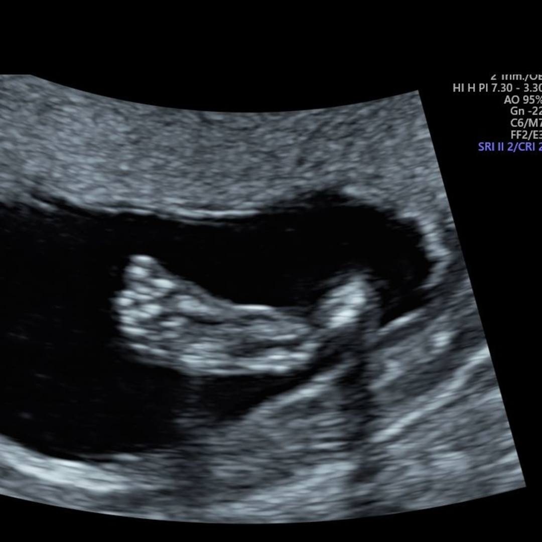 Photo shared by Sarah for their Babylist baby registry.