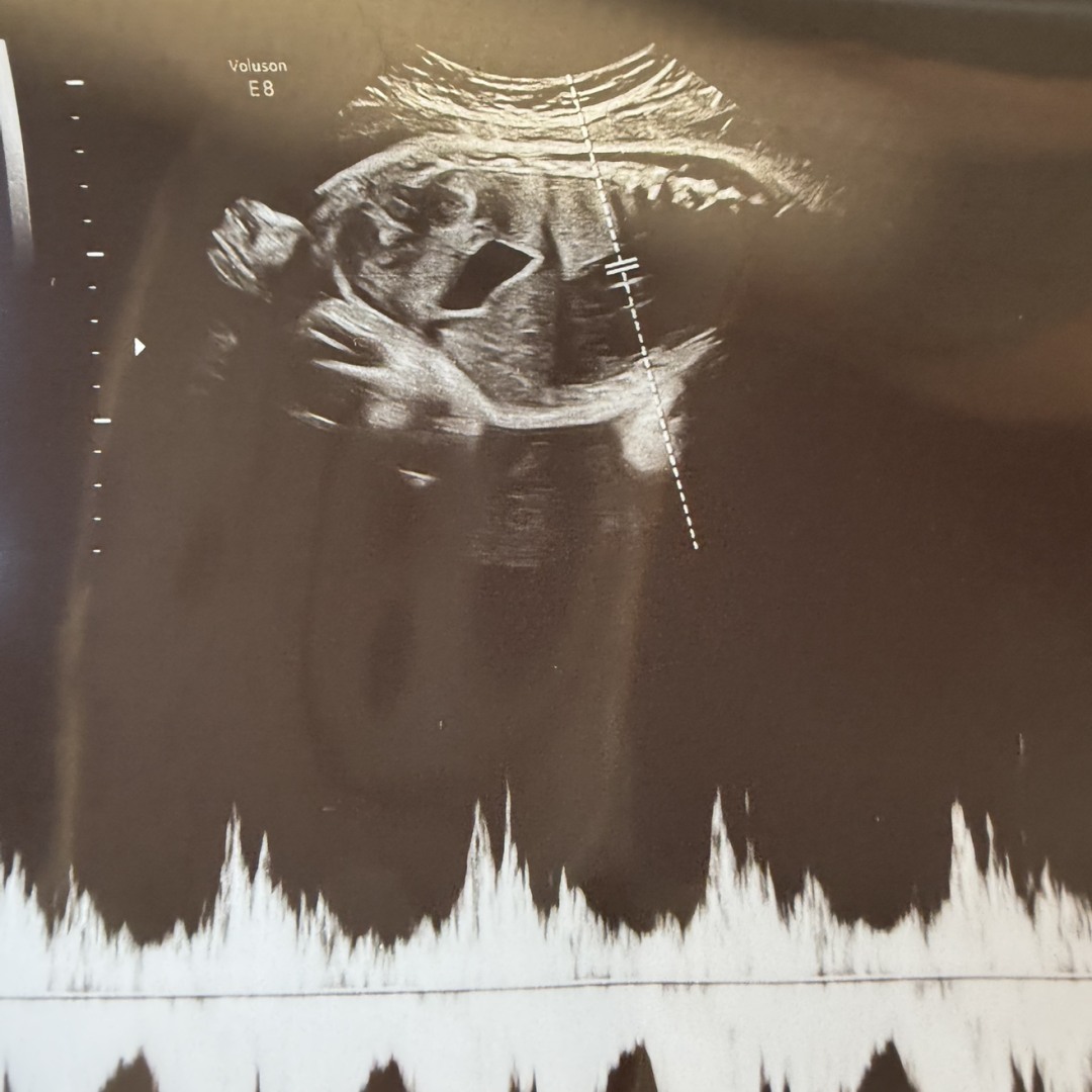 Photo shared by Cassandra for their Babylist baby registry.