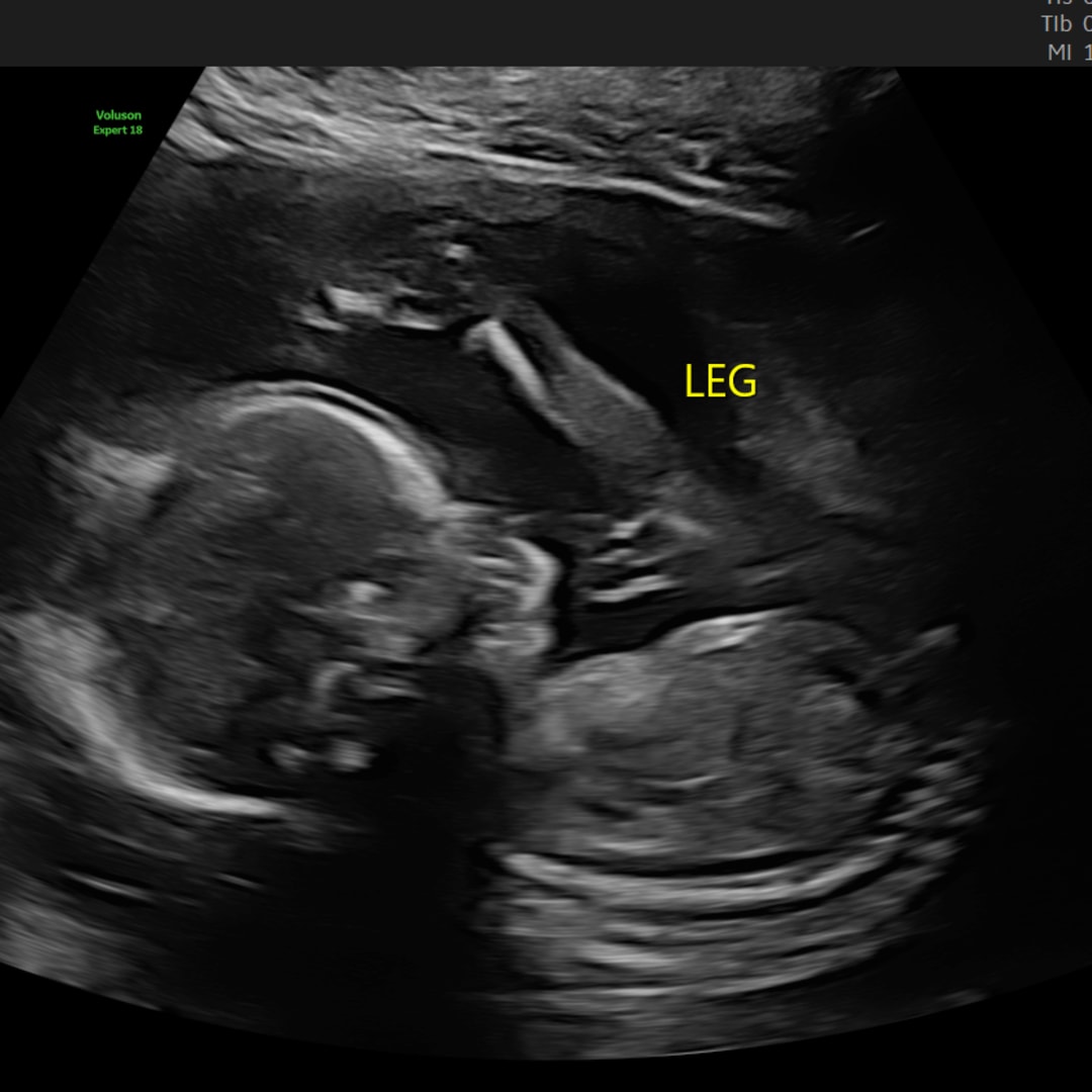 Photo shared by Hannah for their Babylist baby registry.