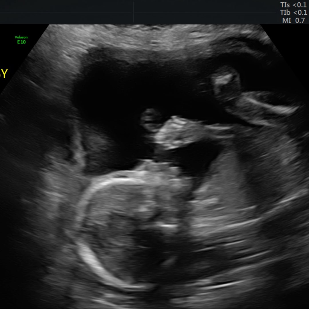 Photo shared by Megan for their Babylist baby registry.