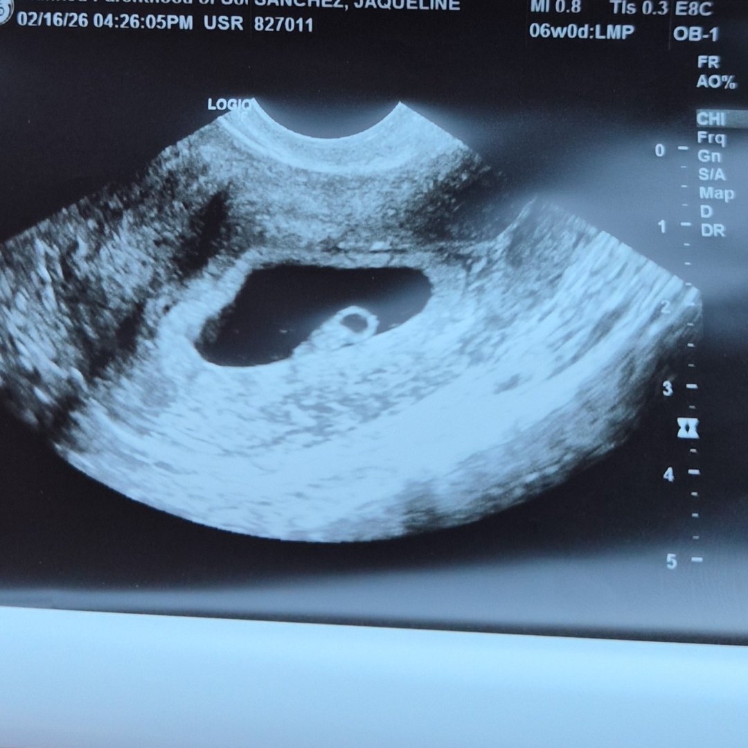 Photo shared by Jacky for their Babylist baby registry.