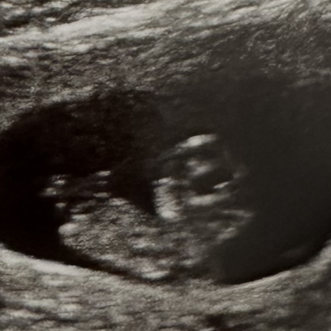 Photo shared by Alessia for their Babylist baby registry.