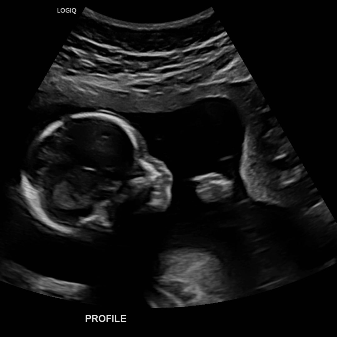 Photo shared by Emily for their Babylist baby registry.