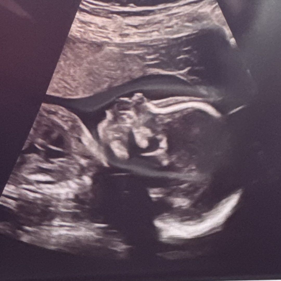 Photo shared by Allie for their Babylist baby registry.