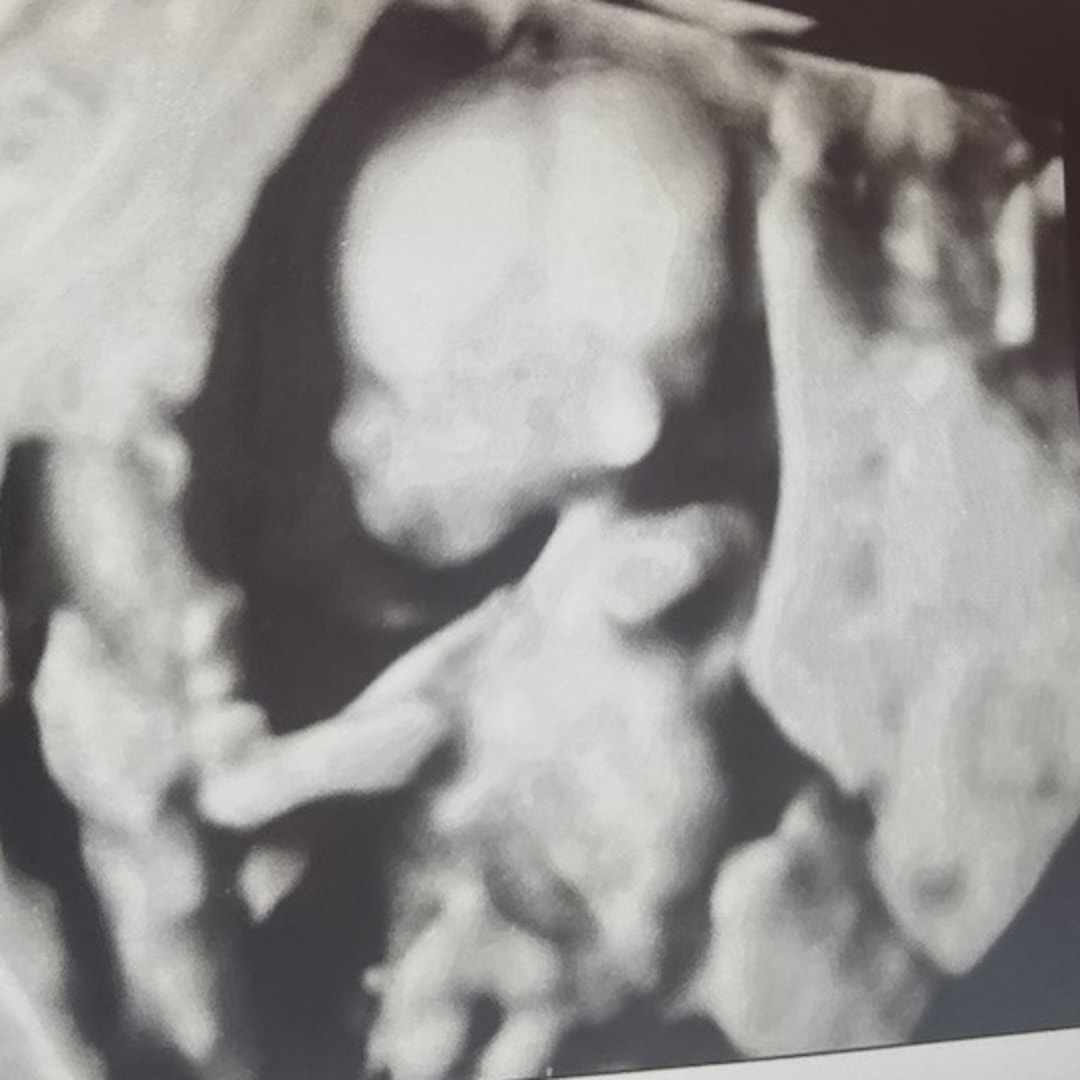 Photo shared by Isabella for their Babylist baby registry.