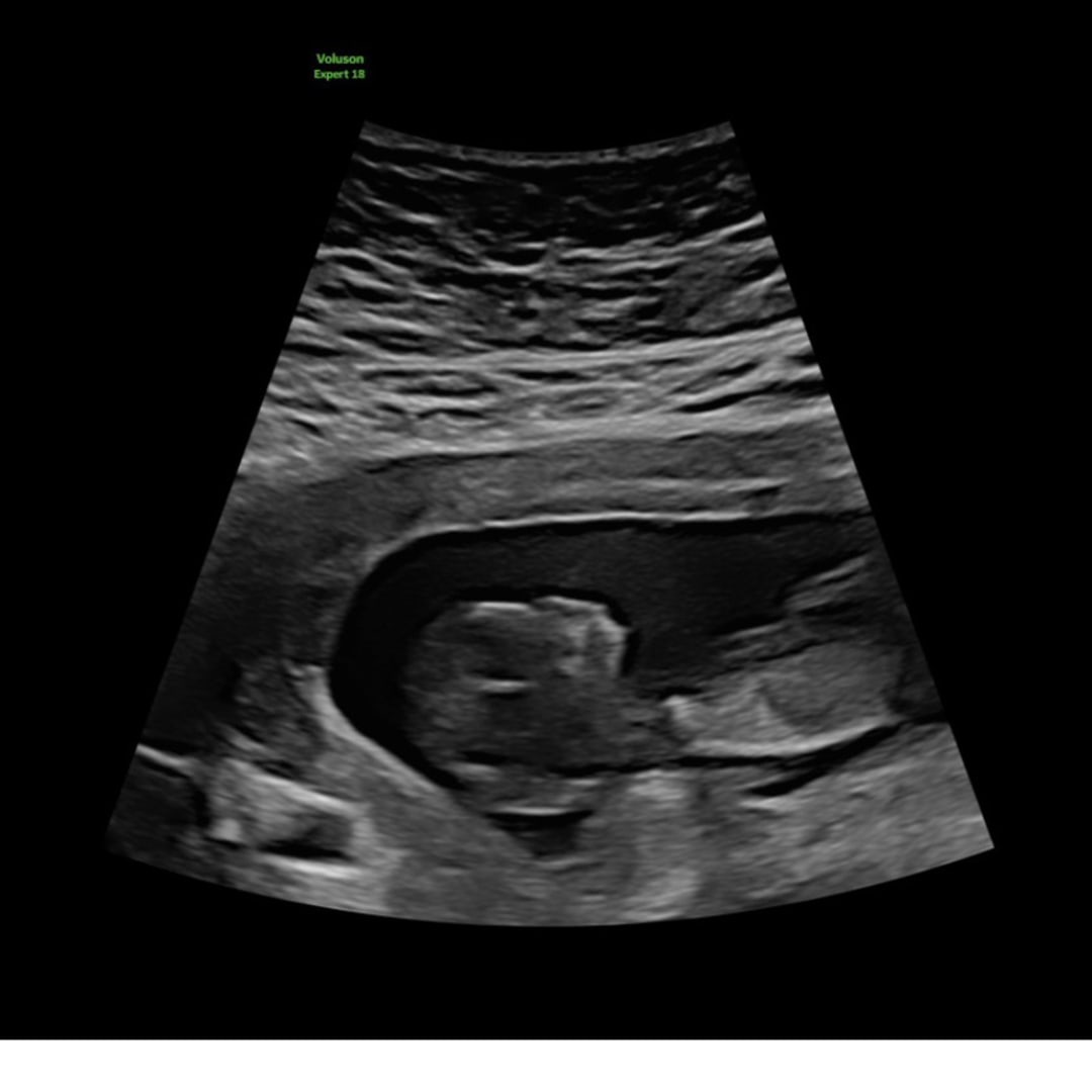 Photo shared by Tiana for their Babylist baby registry.