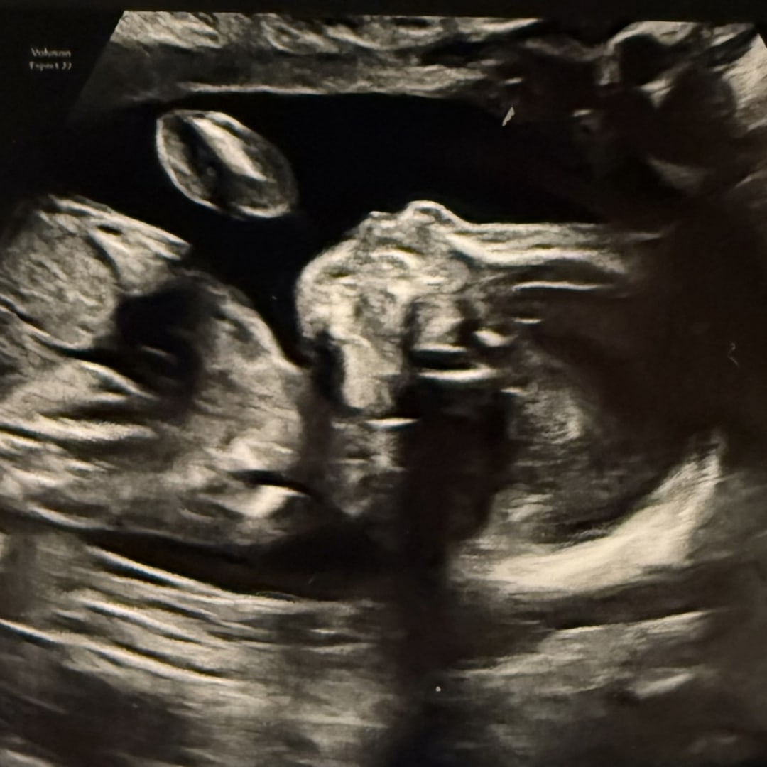 Photo shared by Ashley for their Babylist baby registry.