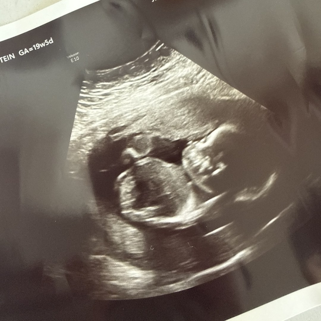 Photo shared by Stephanie for their Babylist baby registry.