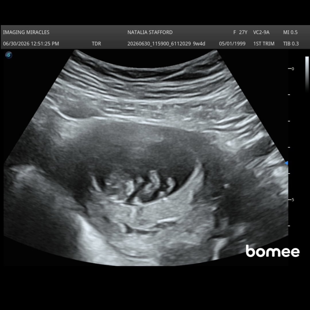 Photo shared by Natalia for their Babylist baby registry.