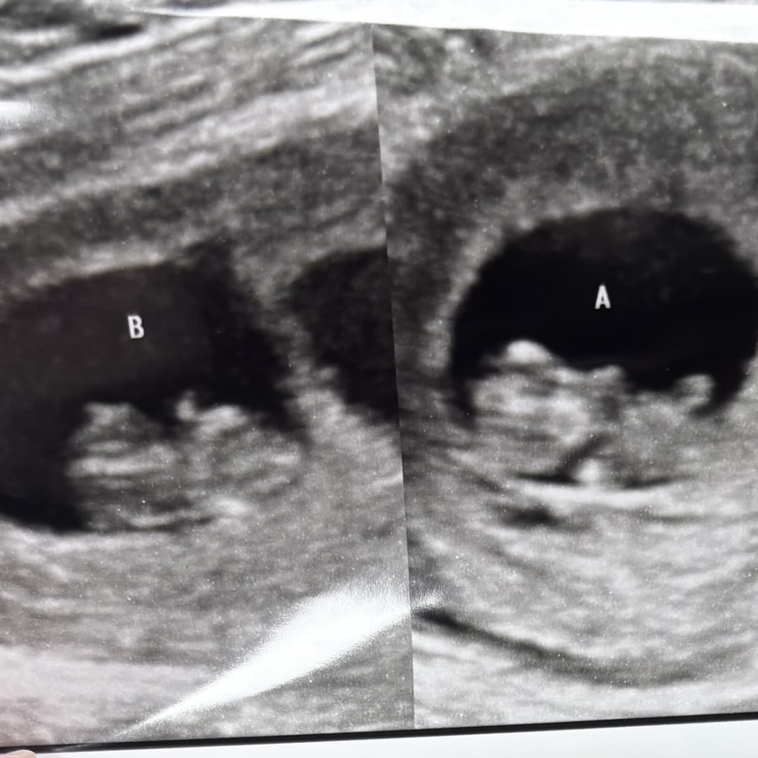 Photo shared by Jazzalee for their Babylist baby registry.