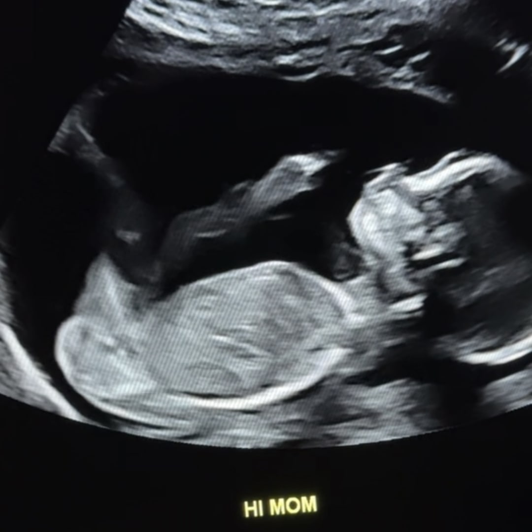 Photo shared by Arielle for their Babylist baby registry.