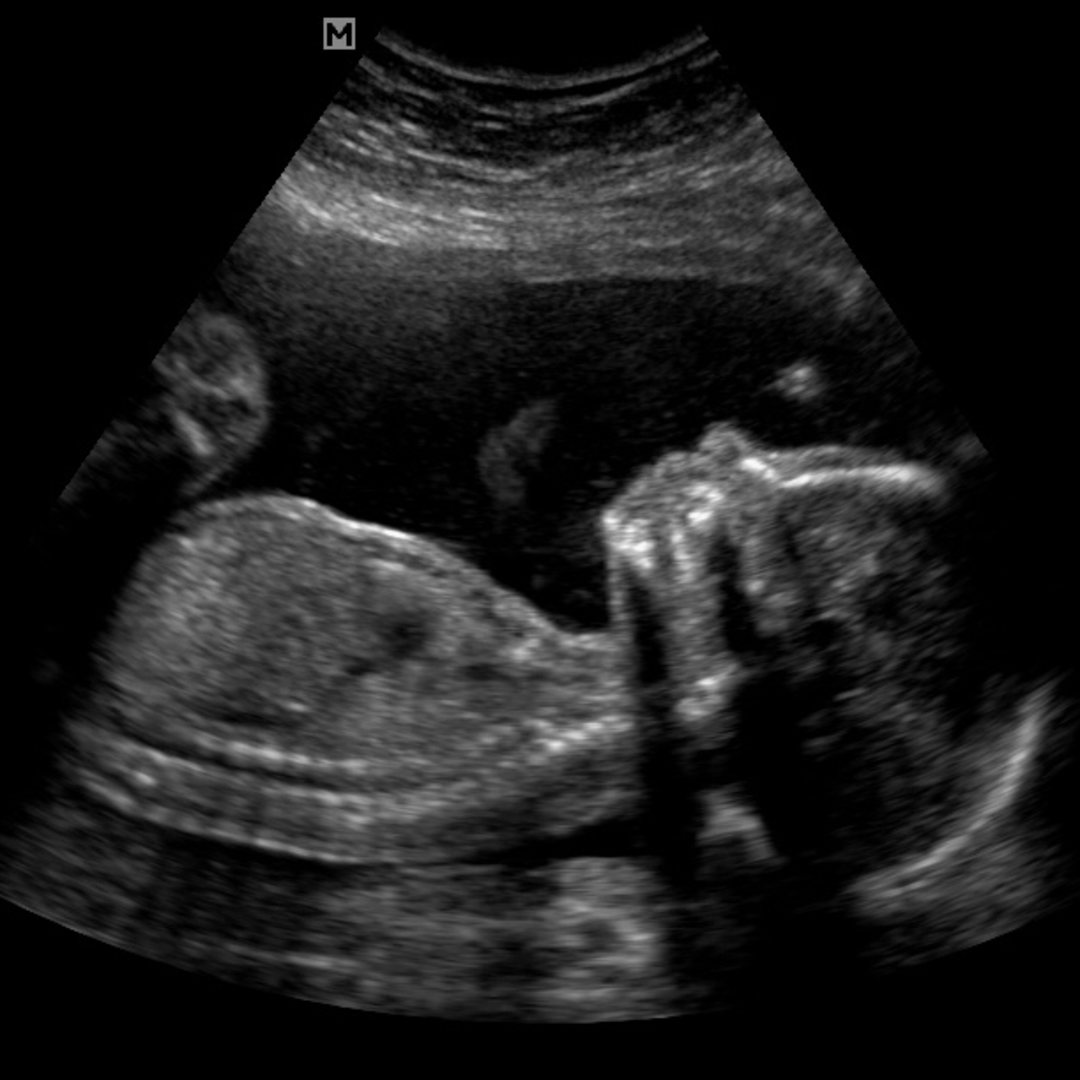 Photo shared by Destiny for their Babylist baby registry.