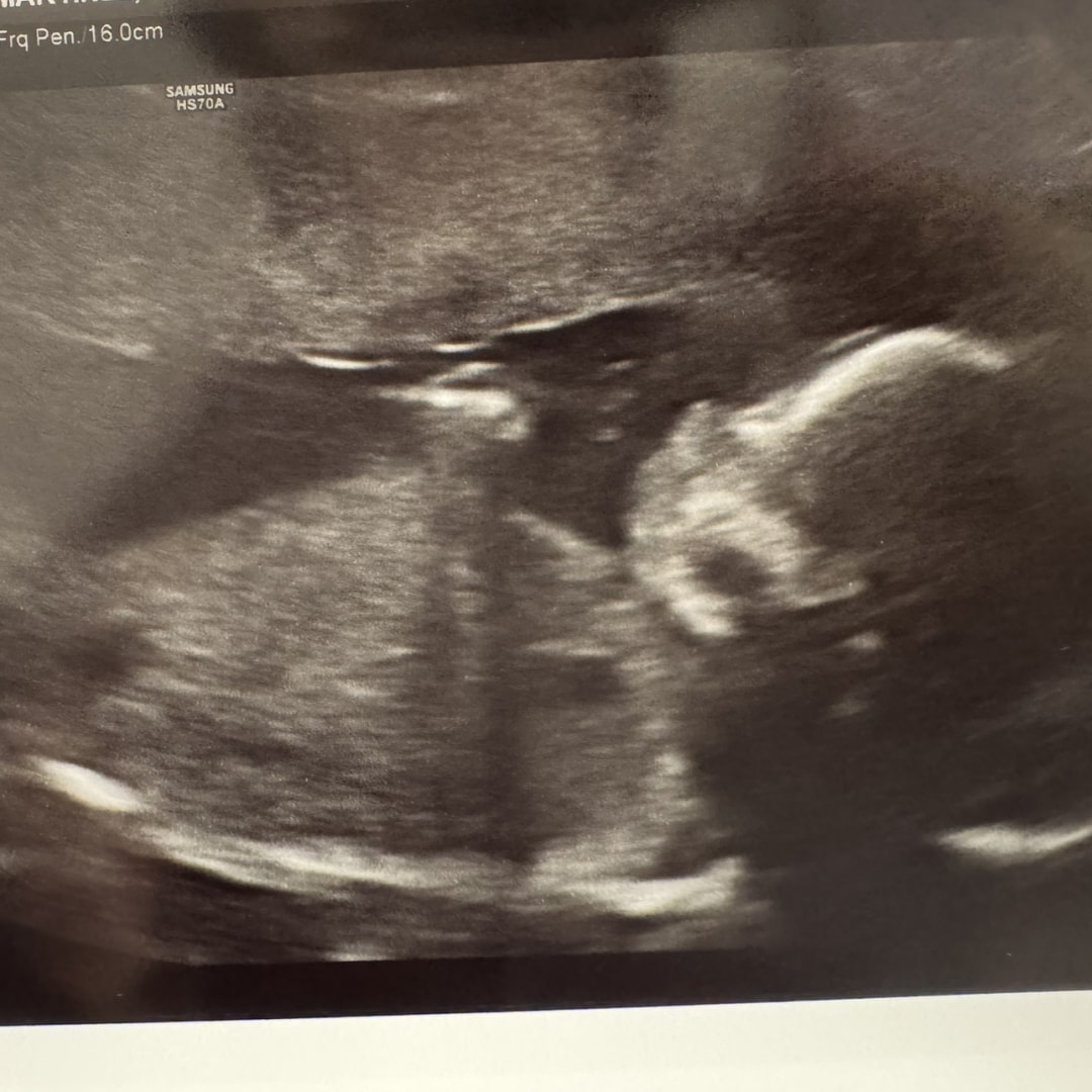 Photo shared by Jaidyn for their Babylist baby registry.