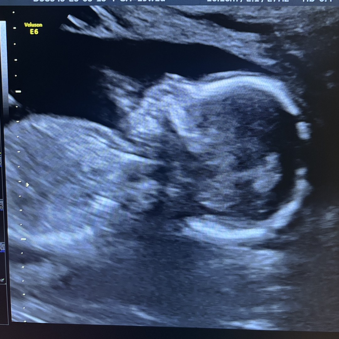 Photo shared by Avery for their Babylist baby registry.