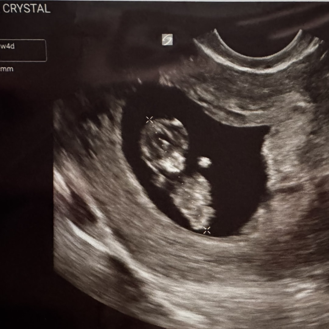 Photo shared by Crystal for their Babylist baby registry.