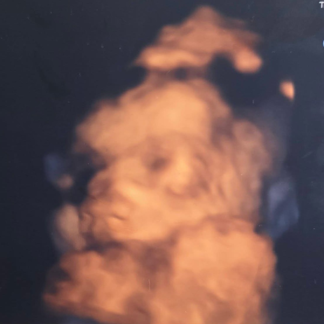 Photo shared by Ashley for their Babylist baby registry.